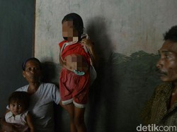 Pemerintah Turun Tangan, Bocah Cirebon Tanpa Anus Segera Operasi