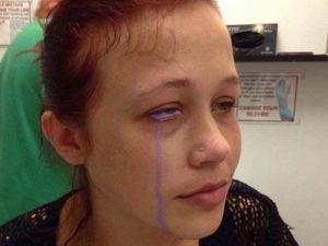 Aneh Tapi Nyata, Wanita Ini Mengeluarkan Air Mata Ungu