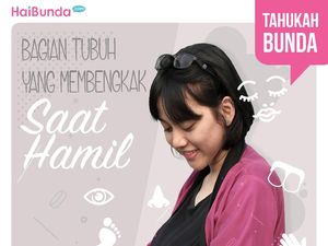 Jangan Salah, Bagian Tubuh Ini Juga Bisa Membengkak Saat Hamil