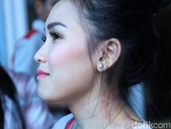 Tanda Merah di Leher Ayu Ting Ting, Ini Artinya Jika Benar Bekas Kerokan