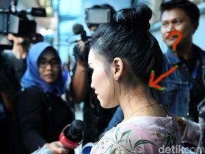 Jejak Terapi Alternatif Para Pesohor, Seperti Dialami Ayu Ting Ting