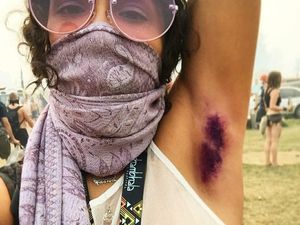 Tren Mewarnai Ketiak di Instagram, Keren atau Aneh? Tren Mewarnai Ketiak di Instagram, Keren atau Aneh?