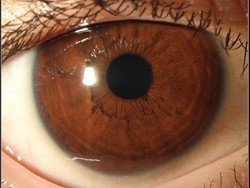 Diet Terlalu Ekstrem, Anak 11 Tahun Kehilangan Fungsi Penglihatan