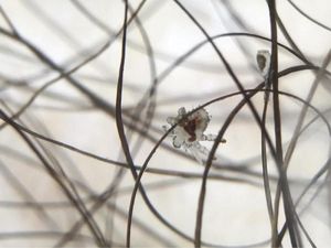 Gegara Kutu Penumpang Pesawat Ini Mendarat Darurat