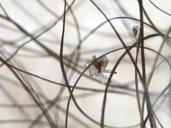 Jepretan Akrobat Kutu Parasit di Rambut Kemaluan Seorang Pria