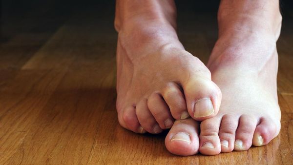 6 Cara Menyelamatkan Kaki dari Bau Tak Sedap di Musim Hujan
