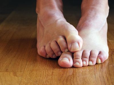 6 Cara Menyelamatkan Kaki dari Bau Tak Sedap di Musim Hujan