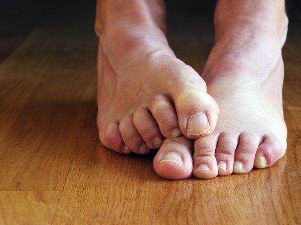 6 Cara Menyelamatkan Kaki dari Bau Tak Sedap di Musim Hujan