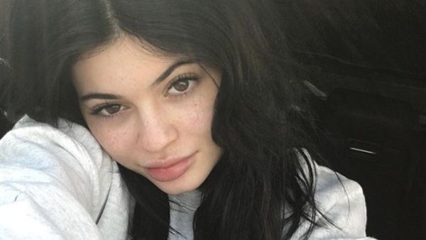 Foto: Saat Selebriti Pamer Freckless di Wajah, Tetap Cantik!