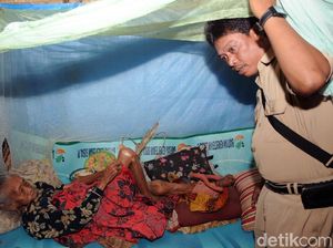 Karimah, Korban Gigitan Monyet Liar di Boyolali Belum Sembuh