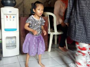 Kondisi Bunga, Bocah Sukabumi yang Diikat Ortu Mulai Membaik