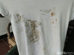 Baju dengan Jejak Sepatu Aparat Jadi Barbuk Kekerasan Pada Wartawan