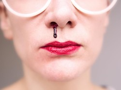 Harus Tahu, 5 Gejala dari Kanker Nasofaring