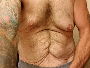 Potret Mereka yang Berhasil Kuruskan Badan Hingga Kulitnya Bergelambir