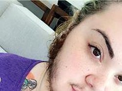 Wajah Dipenuhi Janggut, Wanita Ini Percaya Diri Berkat Dukungan Pacar