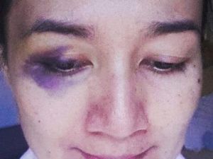 Mata Kiri Nini Carlina Lebam, Begini Kronologinya