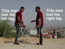 Kisah 2 Pria Gaza yang Kehilangan Sebelah Kaki Usai Diserang Israel