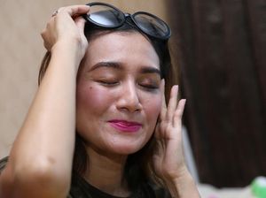 Wajah Lebam Nini Carlina