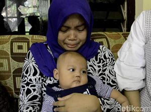 Bayi Pekalongan yang Kehilangan Sekat Hidung Akan Dibedah Plastik