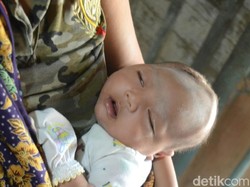 Keluarga Bayi Kenzo Tak Salahkan Dukun Pijat Bayi