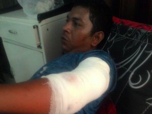Tak Bawa Senter Saat Cari Ikan, Guru Honorer di Aceh Diterkam Buaya Tak Bawa Senter Saat Cari Ikan, Guru Honorer di Aceh Diterkam Buaya