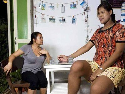 Potret Mereka yang Tidak Bisa Berhenti Tumbuh Karena Gigantisme