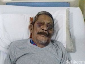 Viral Foto Kakek Hasan Korban Tabrakan, Begini Kisah Sebenarnya