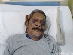 Viral Foto Kakek Hasan Korban Tabrakan, Begini Kisah Sebenarnya