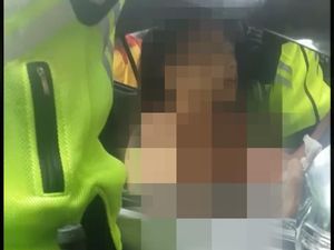 Viral Wanita Buka Baju Setelah Menabrak, Dokter: Itu Reaksi Stres