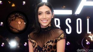 Duh, Millendaru kok Pakai Dress Bolong Sih?