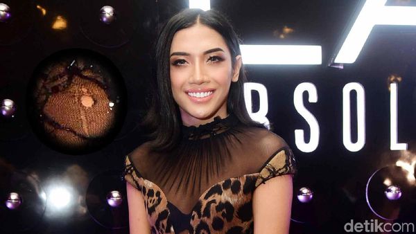 Duh, Millendaru kok Pakai Dress Bolong Sih?