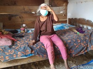 Wajah Nenek Sebatang Kara di Boyolali Ini Digerogoti Kanker Ganas