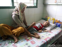 Menengok Kakak Beradik di Solo yang Lumpuh Sejak Kecil