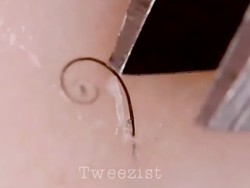 Ngilu! Selebgram Ini Beken Berkat Hobi Mencabuti Bulu Kaki