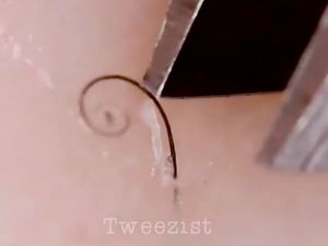 Ngilu! Selebgram Ini Beken Berkat Hobi Mencabuti Bulu Kaki Ngilu! Selebgram Ini Beken Berkat Hobi Mencabuti Bulu Kaki