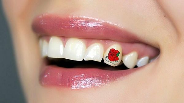 Foto: Tren Baru Tato di Gigi, Kamu Mau Coba?