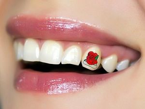 Foto: Tren Baru Tato di Gigi, Kamu Mau Coba?