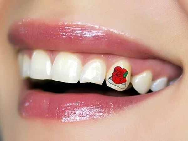 Foto: Tren Baru Tato di Gigi, Kamu Mau Coba?