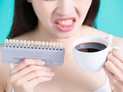 Hati-hati! 5 Makanan Ini Bisa Bikin Gigi Berwarna Kuning