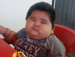 Umur 10 Bulan, Bayi Ini Beratnya Sama dengan Anak 9 Tahun