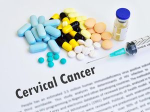 Ciri-ciri Kanker Serviks yang Tak Boleh Disepelekan, Termasuk Keputihan Ciri-ciri Kanker Serviks yang Tak Boleh Disepelekan, Termasuk Keputihan