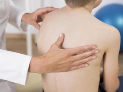 Tulang Belakang Bengkok 92 Derajat Bisa Berkurang Berkat Olahraga