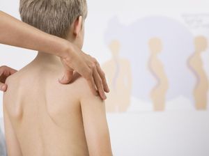 Duh! Mata Wanita Ini Berdarah Usai Jalani Chiropractic