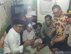 Ridwan Kamil Beri Kejutan Ultah Pada Rachel Korban Minyak Panas