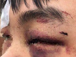 Siswa Asal China Dipukul di Canberra