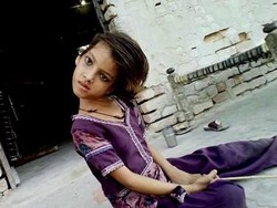 Penyakit Misterius Bikin Kepala Anak Ini Miring 90 Derajat