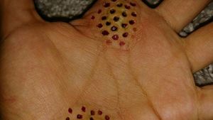 Potret Efek Spesial yang Bisa Bikin Merinding Si Pemilik Trypophobia