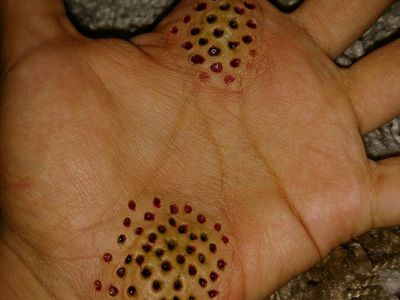 Potret Efek Spesial yang Bisa Bikin Merinding Si Pemilik Trypophobia