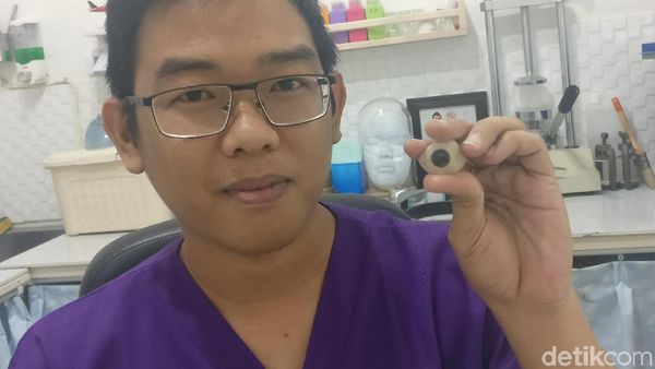 Buat yang Penasaran, Begini Tahap-tahap Mata Palsu Dibuat