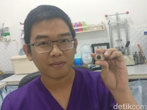 Buat yang Penasaran, Begini Tahap-tahap Mata Palsu Dibuat